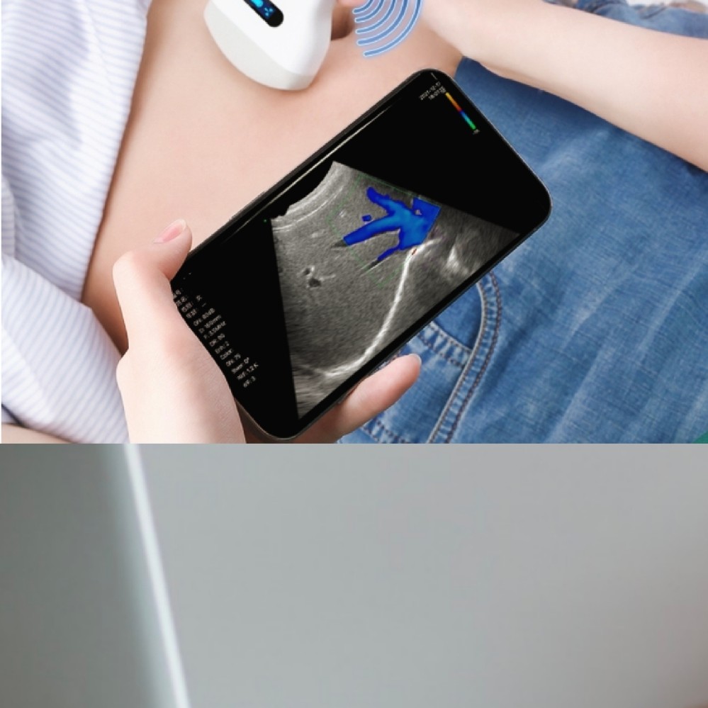 彩色多普勒超聲系統